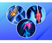 Best hospital for knee replacement -Advanced Orthopedic Care