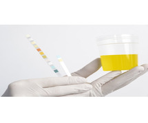 Get Fast and Precise Urine Culture Test at Max Lab