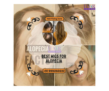 Alopecia-Friendly Wigs & Toppers for a Natural Appearance