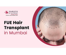 FUE Hair Transplant in Mumbai