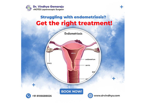 Best Endometriosis Treatment In Hyderabad | Dr. Vindhya Gemaraju