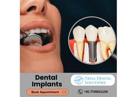 Trisa Dental Solutions : Best Dental Implants Clinic in Mumbai