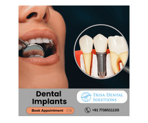 Trisa Dental Solutions : Best Dental Implants Clinic in Mumbai