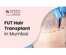 FUT Hair Transplant in Mumbai