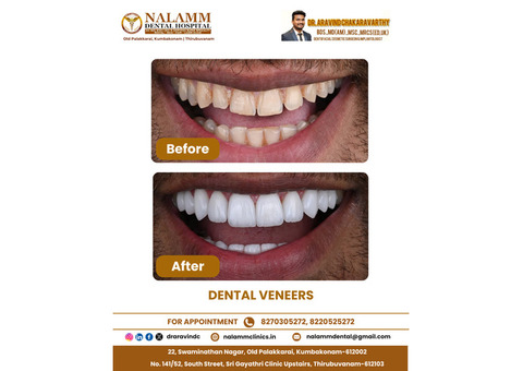 Smile Designing In Kumbakonam