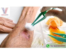 Diabetic Wound Care Specialist in Hyderabad | Vascularhyd