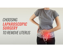 Laparoscopic surgery to remove uterus in bangalore | Worldofurology