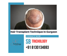 Check Our Hair Transplant Technique In Gurgaon