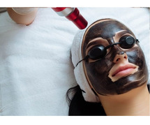 Carbon Peel Treatment in Delhi: Achieve Glowing, Clear Skin