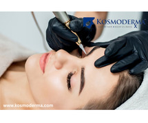 Microblading Permanent Eyebrow Treatment in Bangalore - Kosmoderma Clinic