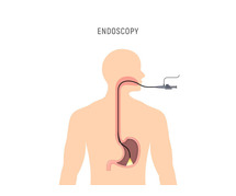 A Safe and Comfortable Solution for Your Digestive Health