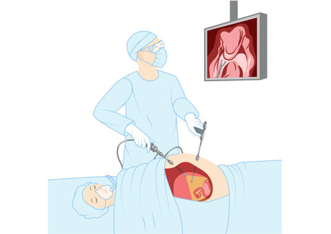 Advanced Care & Quick Recovery with Minimally Invasive Surgery