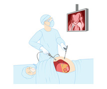 Advanced Care & Quick Recovery with Minimally Invasive Surgery