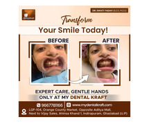 Best Dental doctor in Indirapuram