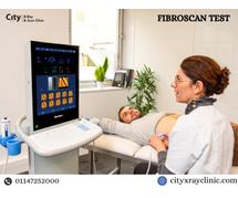 Find a Quick & Easy FibroScan Test Near You Today