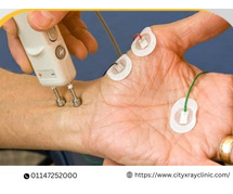 NCV Test Price Simple Guide to Cost & What’s Included