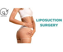 Get Slim & Sculpted: Liposuction Surgery In Hyderabad Today