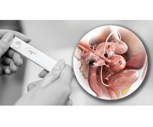 How Hormones Influence Endometriosis: Insights from Balaji Horizon Women’s Hospital
