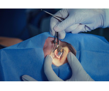 Cataract specialist in Kozhikode