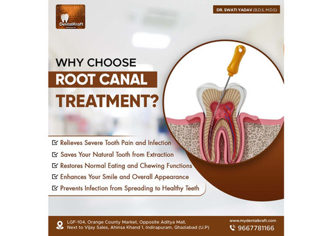 Best RCT Clinic in Indirapuram for Tooth Pain