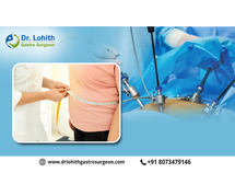 Best Bariatric Surgeon in Bangalore
