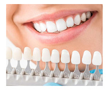 Nagu Dental Specialty | Dental Clinic In RR Nagar, Bangalore
