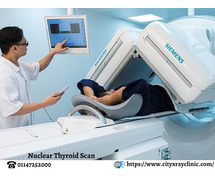Nuclear Thyroid Scan: Cost, Procedure & What to Expect
