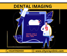 Quick & Safe Dental X-Ray Near You Book Today