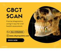 CBCT Scan Price: What to Expect & How to Save on Costs
