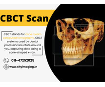 CBCT Scan Price Guide What You Should Know