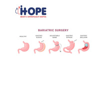 Is Bariatric Surgery Right for You?