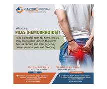 Best Piles Doctor in Ahmedabad - Dr. Ruchir Patel at Gastro1