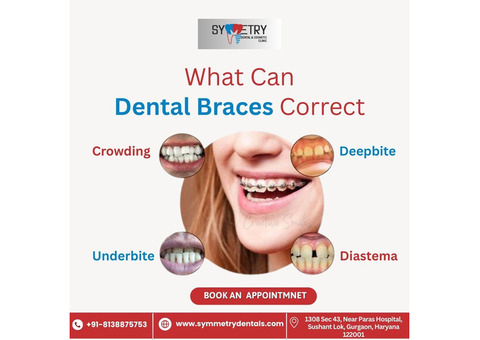 Best Braces Specialist in Gurgaon