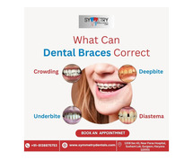Best Braces Specialist in Gurgaon