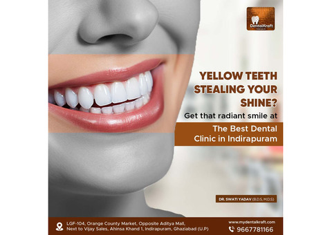 Best Dental Clinic in Indirapuram