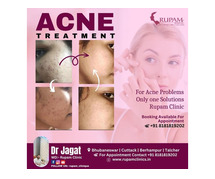 Best Acne Peel Treatment Clinic in Bhubaneswar – Visit Rupam Clinic