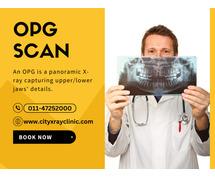 OPG X-Ray Cost What You Should Expect to Pay