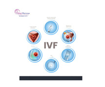 Understanding IVF Risks and Considerations: What Every Couple Should Know