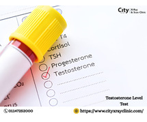 Testosterone Level Test Price What to Expect