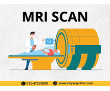 MRI Test Price Know the Cost Before You Book