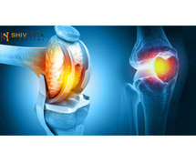 When Should You Consider Knee Replacement Surgery?