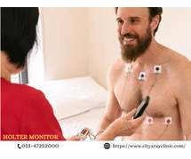 Holter Test Cost: What to Expect & How to Save Money