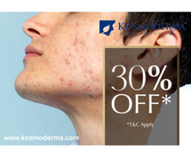Effective Acne Treatment in Bangalore - Kosmoderma Skin and Hair Clinic
