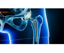 Explore the Different Types of Hip Replacement Surgery