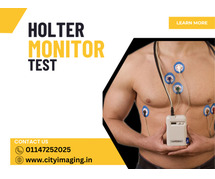 Holter Monitor Test Cost What to Expect & Save