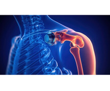 Shoulder Replacement Doctors in Kerala