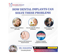 Nagu Dental Speciality | Full Mouth Implant In India