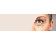 Blepharoplasty cost in Mumbai- Eyelid Lift Operation