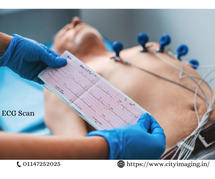 ECG Test Price What It Costs & What to Expect