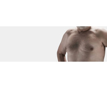 Gynecomastia Surgery in Delhi - SB Aesthetics Clinic